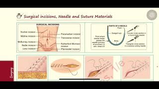 Download Lagu Named incisions✅ suture types , suture materials🧶 - high probability image based questions|Medtuber MP3