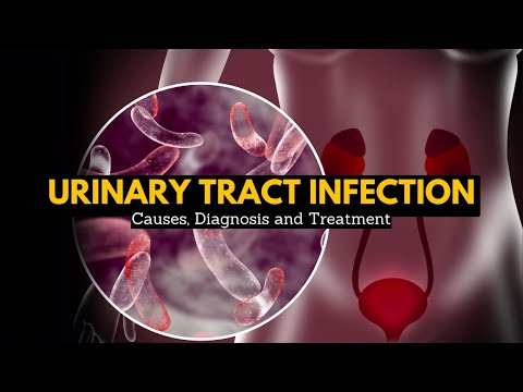 Urinary Tract Infection, Causes, Signs and Symptoms, Diagnosis and Treatment.
