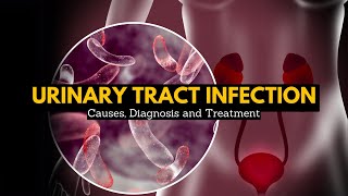 Urinary Tract Infection, Causes, Signs and Symptoms, Diagnosis and Treatment.