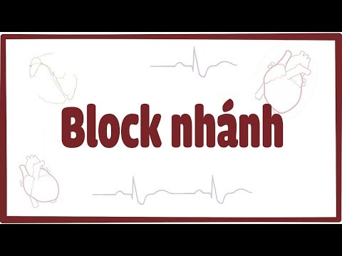 Video: RBBB, là khối nhánh bên phải