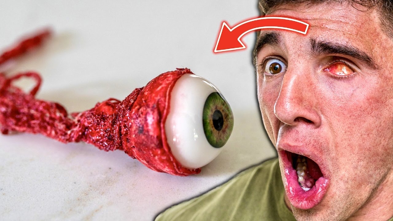 i got a new eyeball..