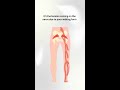 Sciatica recovery, walking without leg pain