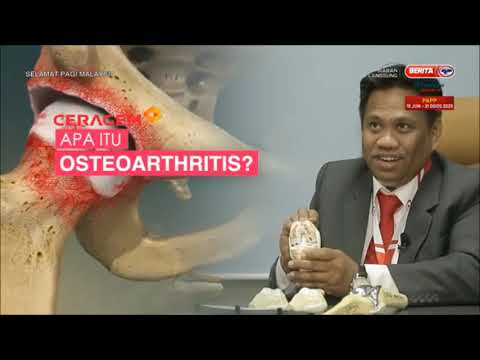 Video: Apakah itu osteoarthritis tarsometatarsal?