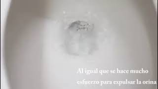 Urologo en Tlaxcala Hugo Sanchez Corona, Retención urinaria en Tlaxcala