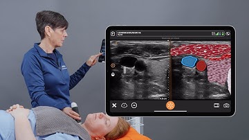 Clarius T-Mode™ for Head & Neck