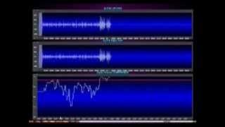 EEG Coherence