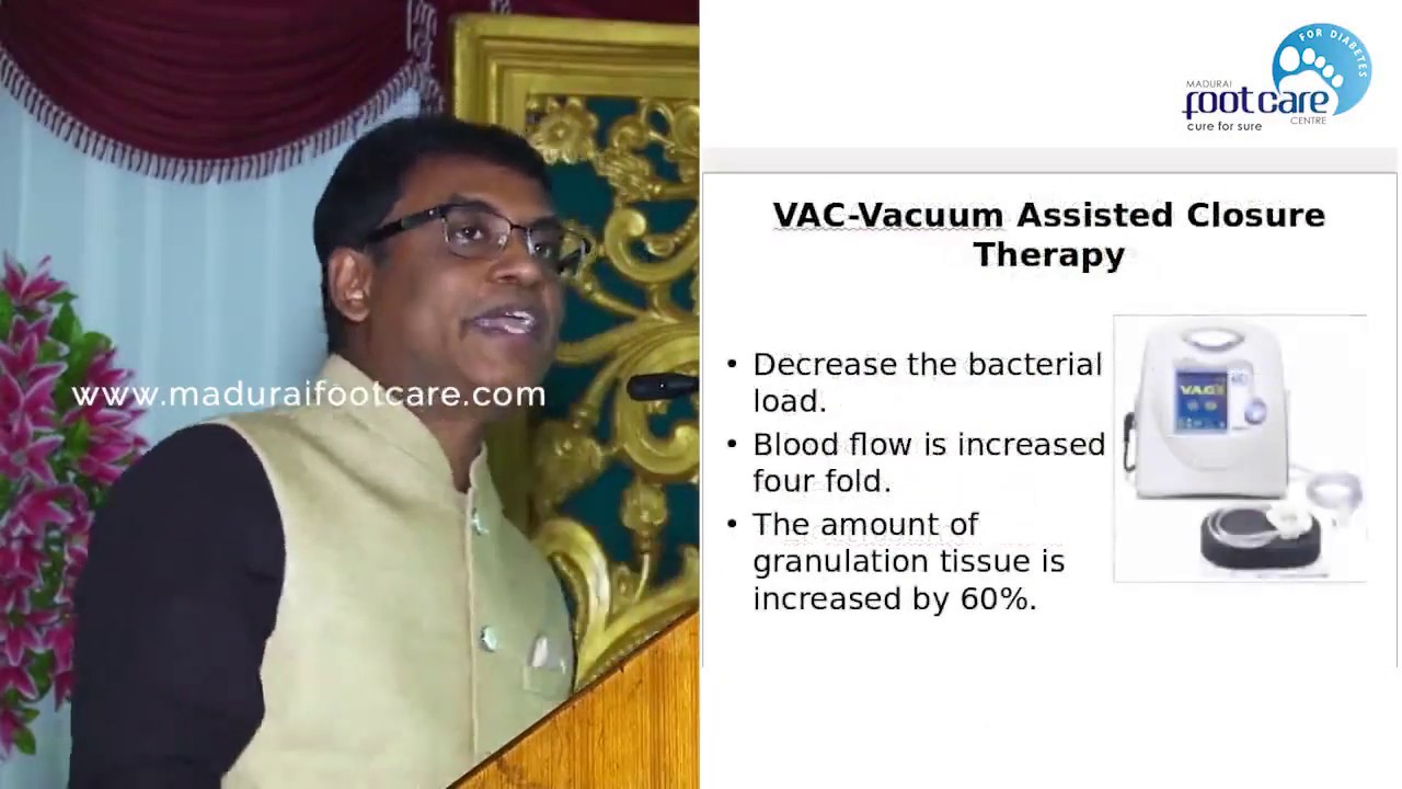 Advanced wound care modalities Madurai Foot Care Centre Madurai