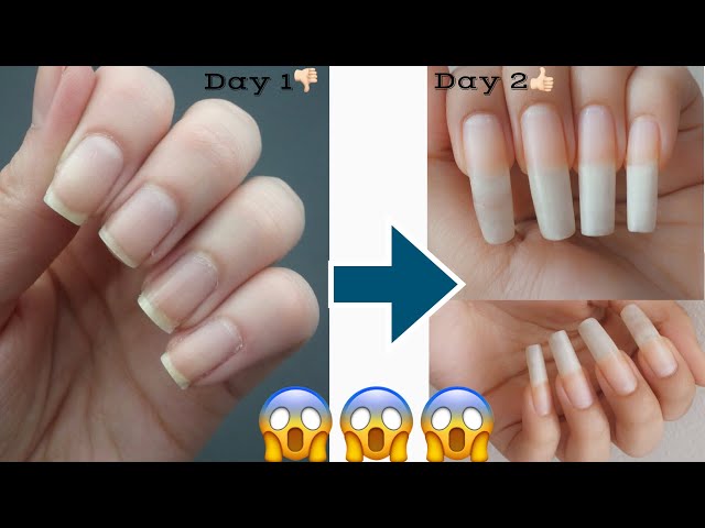 how to grow nails faster/ how to grow nails faster in one week/nail growth  rate/