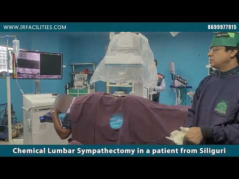 chemical lumbar sympathectomy in a patient from siliguri.