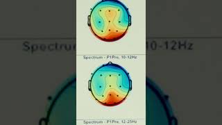 Aires BrainWave Tour LA | Garret's Brain Scan with Aires