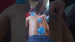 Cupping or Vendosa Massage 50 15 minutes Hawthorn Woods Winnetka Antioch