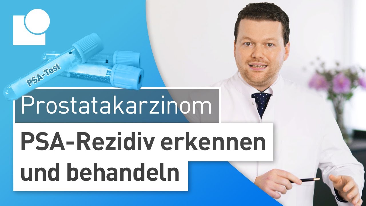 Rezidiv Des Prostatakarzinoms Was Tun Bei Steigendem PSA Wert YouTube rezidiv-des-prostatakarzinoms-was-tun-bei-steigendem-psa-wert-youtube