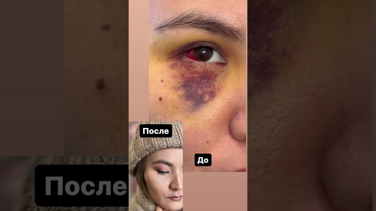 синяки под глазами как скрыть корректор и консилер #trend #топ #хочуврек #макияж #makeup #прически