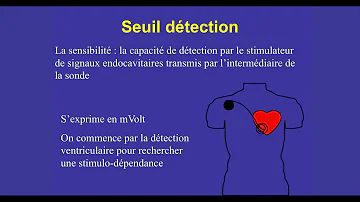 Comment régler un pacemaker ?