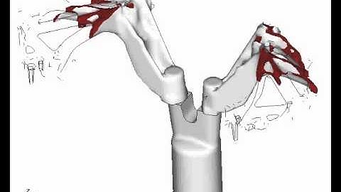 Casting simulation example 03