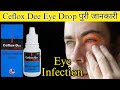Ceflox dee eyeear drop  ciprofloxacin  dexamethasone eyeear drops  dose  side effects