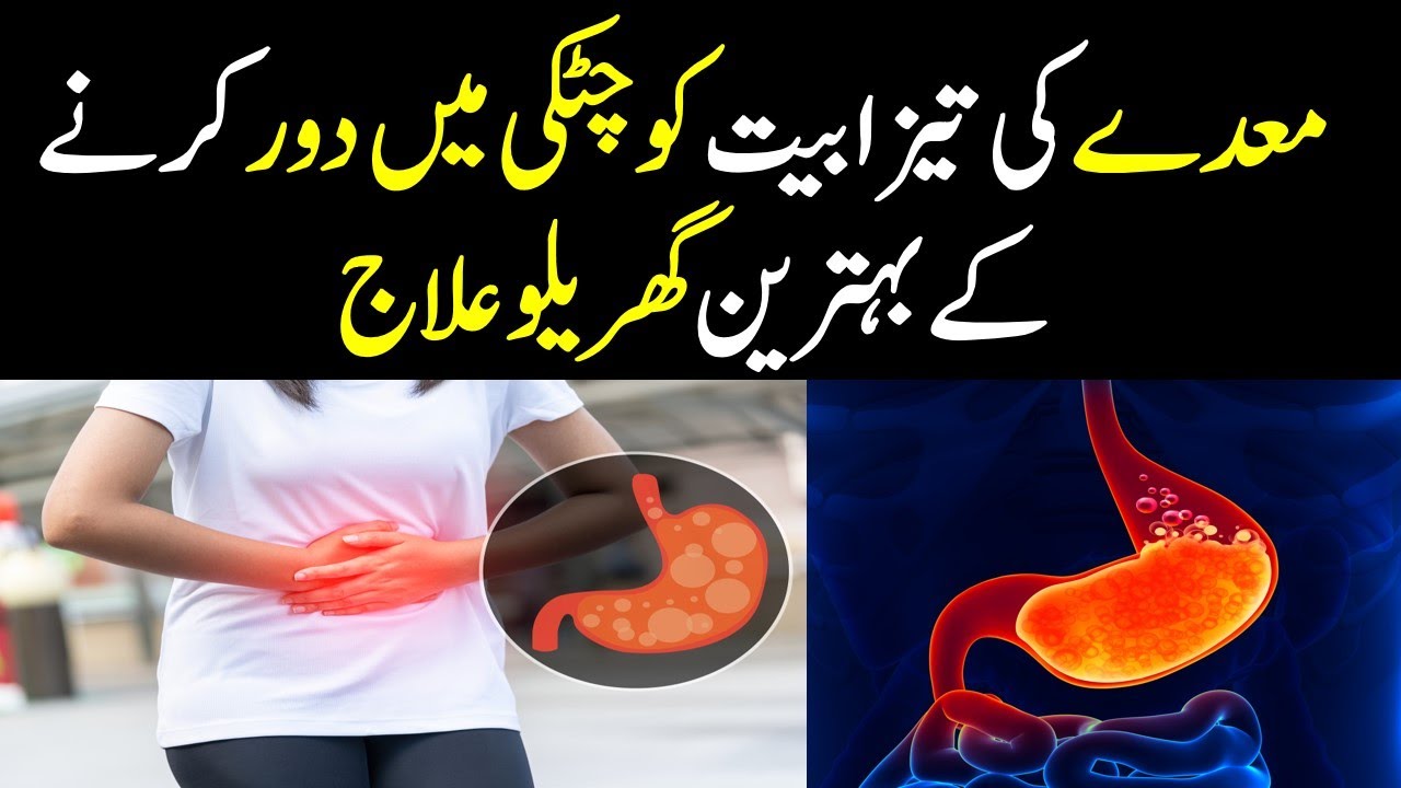 Best Home Remedies For Acidity And Heartburn In Urdu YouTube