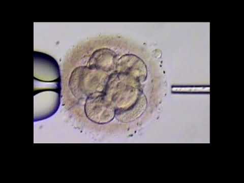 Mangle Opmærksom Springboard Assisted Hatching of Embryos Increases IVF Success Rates