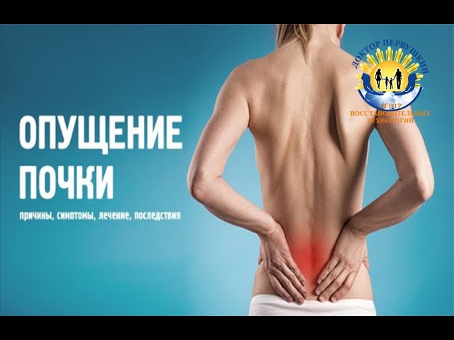 Опущение почки (нефроптоз)