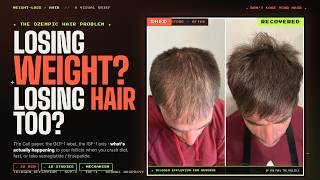 Hair Loss From Weight Loss: How To Prevent It (The Science) - GLP-1, Fasting, Keto, and more...