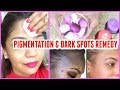 Skin Whitening Natural remedy Dark Spots & Pigmentation Treatment | SuperPrincessjo