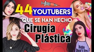 44 YOUTUBERS QUE SE HAN HECHO CIRUGÍA PLÁSTICA :O - 52 Rankings