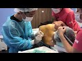 ３年前の他院の再手術！取り残された二の腕の皮下脂肪を根こそぐ！術中劇的変化