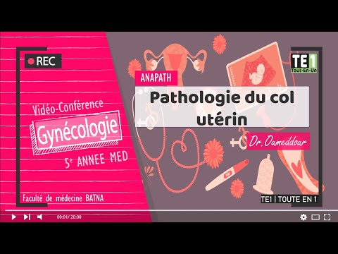 Vidéo: Efficacité Contraceptive Du Facteur D'agglutination Des Spermatozoïdes De Staphylococcus Warneri, Isolé Du Col De L'utérus D'une Femme Présentant Une Stérilité Inexp