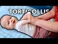 4 MONTH OLD WITH TORTICOLLIS (Treated By Massage Therapist)