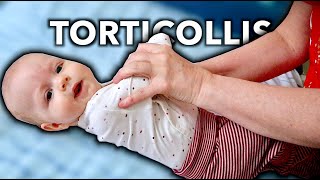 4 MONTH OLD WITH TORTICOLLIS (Treated By Massage Therapist)