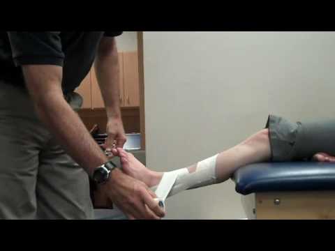 Peroneal Ankle Taping - YouTube