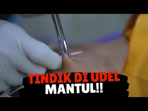 Video: Menindik Tombol Perut: Petua Pembersihan & Banyak Lagi