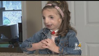 Wonder Movie Touches Home For Haverhill Girl With Treacher Collins Syndrome