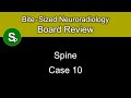 Neuroradiology Board Review - Spine Case 10