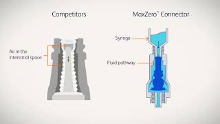 BD MaxZero™ Micro-Learning Episode 6: Why Choose BD MaxZero™