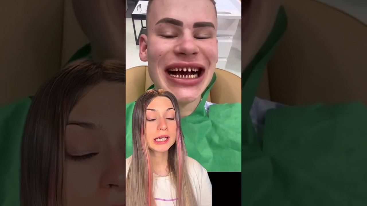 Надо ли сильно обтачивать зубы под виниры? #стоматология #виниры - YouTube