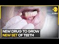 This drug could allow you to grow new teeth  latest news  wion