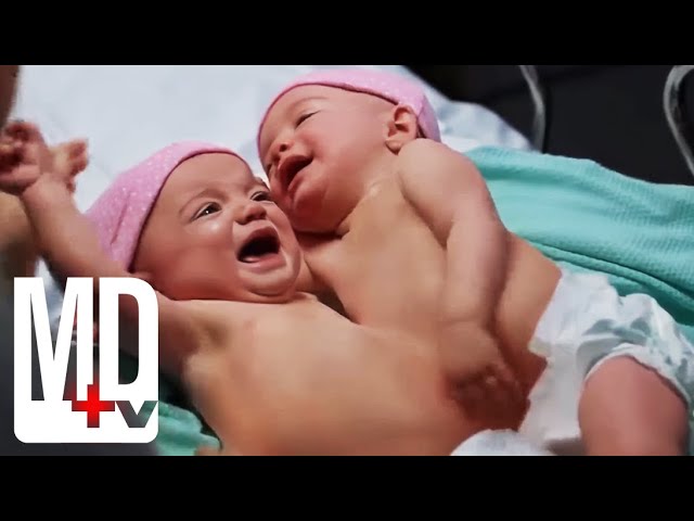 Trying to Save Both Conjoined Twins | Chicago Med | MD TV class=