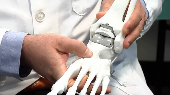 Dr. Thomas Roukis talks about total ankle replacement