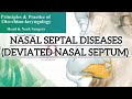 NASAL SEPTAL DISEASES (PART-2) |DEVIATED NASAL SEPTUM| SMR, SEPTOPLASTY &amp; RHINOPLASTY