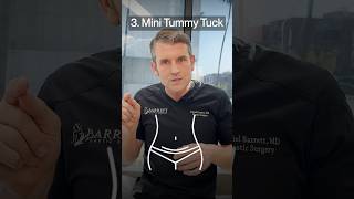 4 Types Of Tummy Tucks! 👙✨