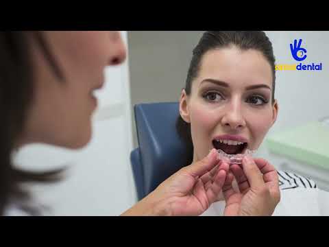 Video Niềng răng trong suốt là gì | Nha khoa anna - youtube