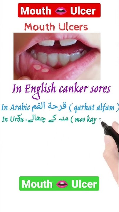Mouth Ulcer Meaning In Arabic Urdu Hindi And Bangla shortvideo mouth-ulcer-meaning-in-arabic-urdu-hindi-and-bangla-shortvideo