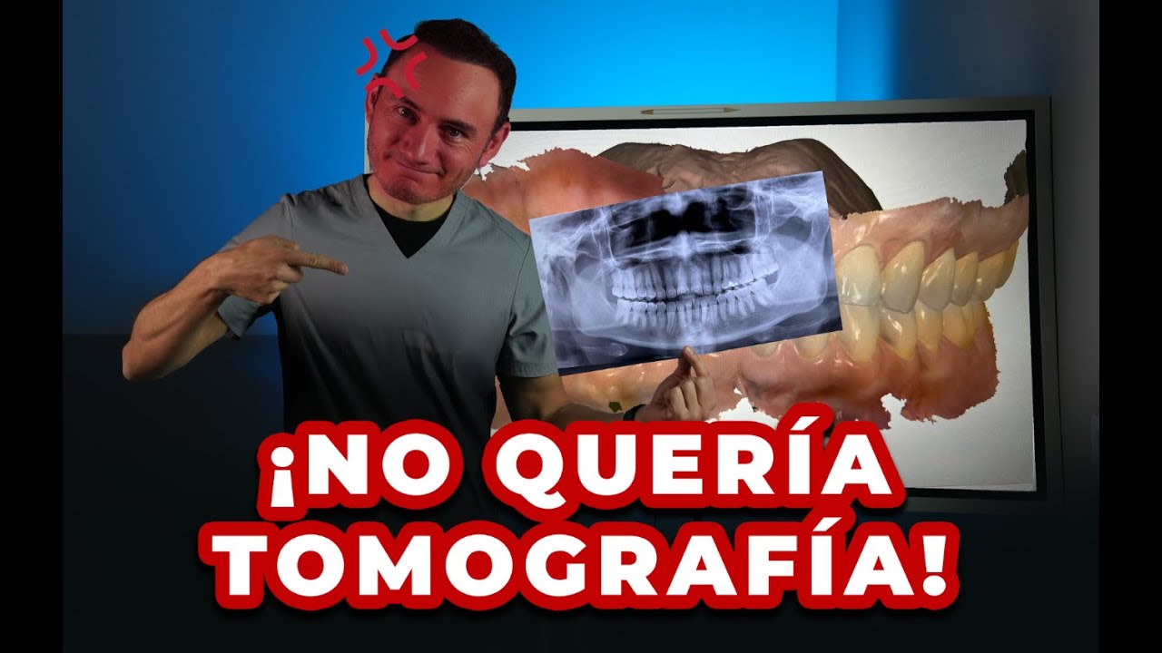 Nunca dependas de una radiografía panorámica