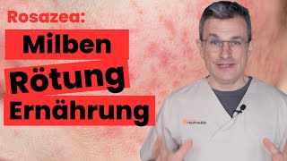 Dein Weg aus der Rosazea-Falle: Ernährung, Laser, Medikamente. Dr. Kasten Hautarzt in Mainz