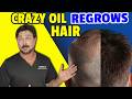 Botanical Oil Now PROVEN To Regrow Hair Mp3 Song