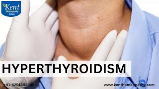 Hyperthyroidism अतिगलग्रंथिता./Kent homeopathy powai Mumbai/Dr Kukreja A kalani