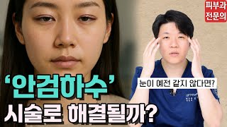 안검하수, 피부과 시술로 해결할 수 있을까? 3가지 시술 추천｜피부과 전문의