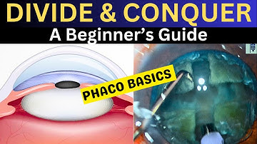 Phaco Basics:A Beginner
