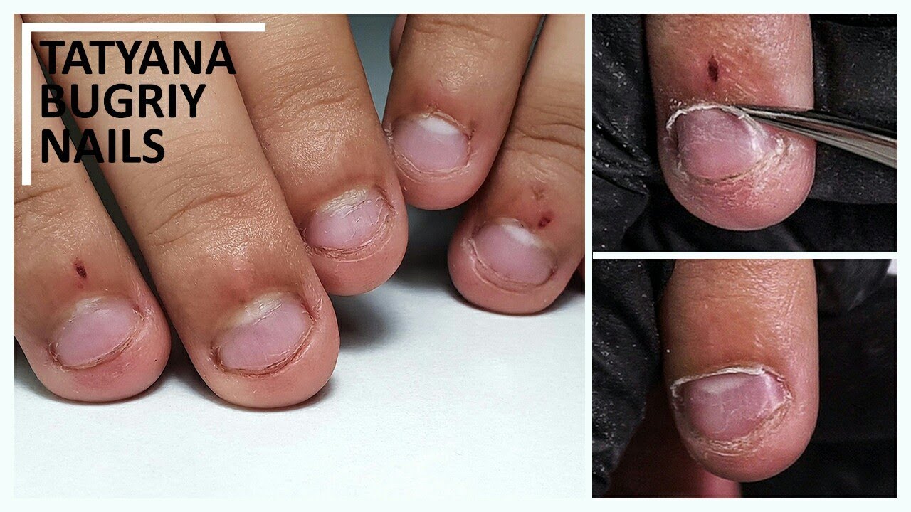 NL Nails - I wish I took a before 🙄😫 Badly bitten... | Facebook